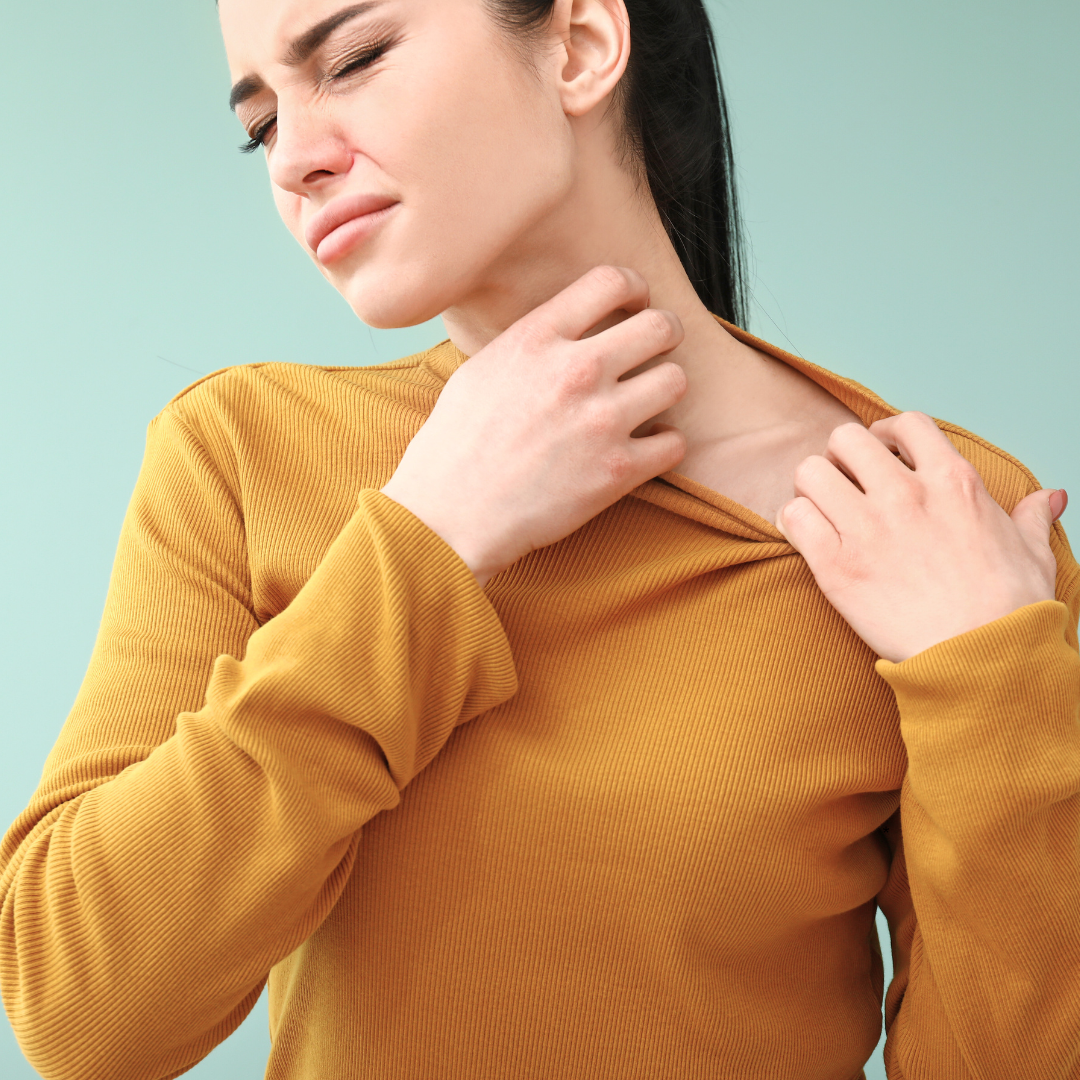Woman experiencing stress-induced hives, scratching her irritated skin with discomfort.